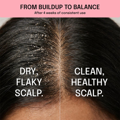 1786597640_Before___After